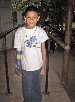 José Eduardo está contento porque tiene su prótesis, afirmó su mamá. Cortesía Laura González.
