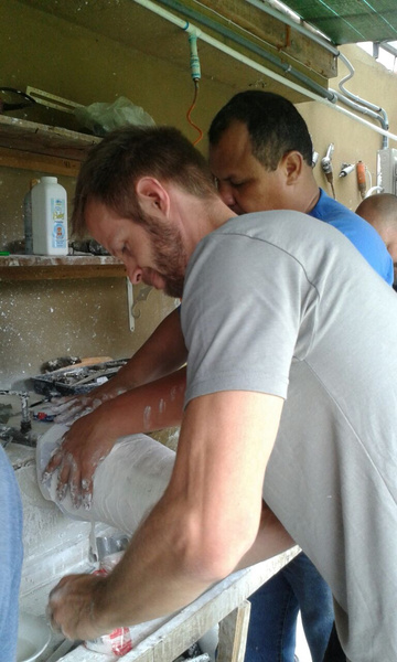 14 personas amputadas tienen una nueva oportunidad