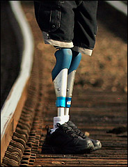 Servicios Protésicos